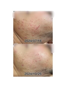 ドルフィン(Dolphin)/★お客様ビフォーアフター