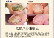 巻き爪補正店 鹿児島店
