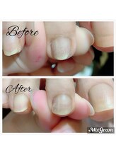 プチブラン 大船店(Petit Blanc)/ビフォーアフター