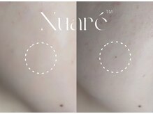 話題奮闘中の最新シミケア肌管理がプティカドーに登場♪