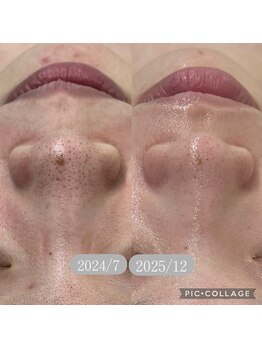 ラ ミュエル(La miel)/なりたい肌へ“韓国最先端