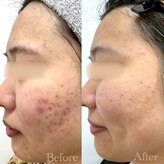 アスポーテ(ASBEAUTE)