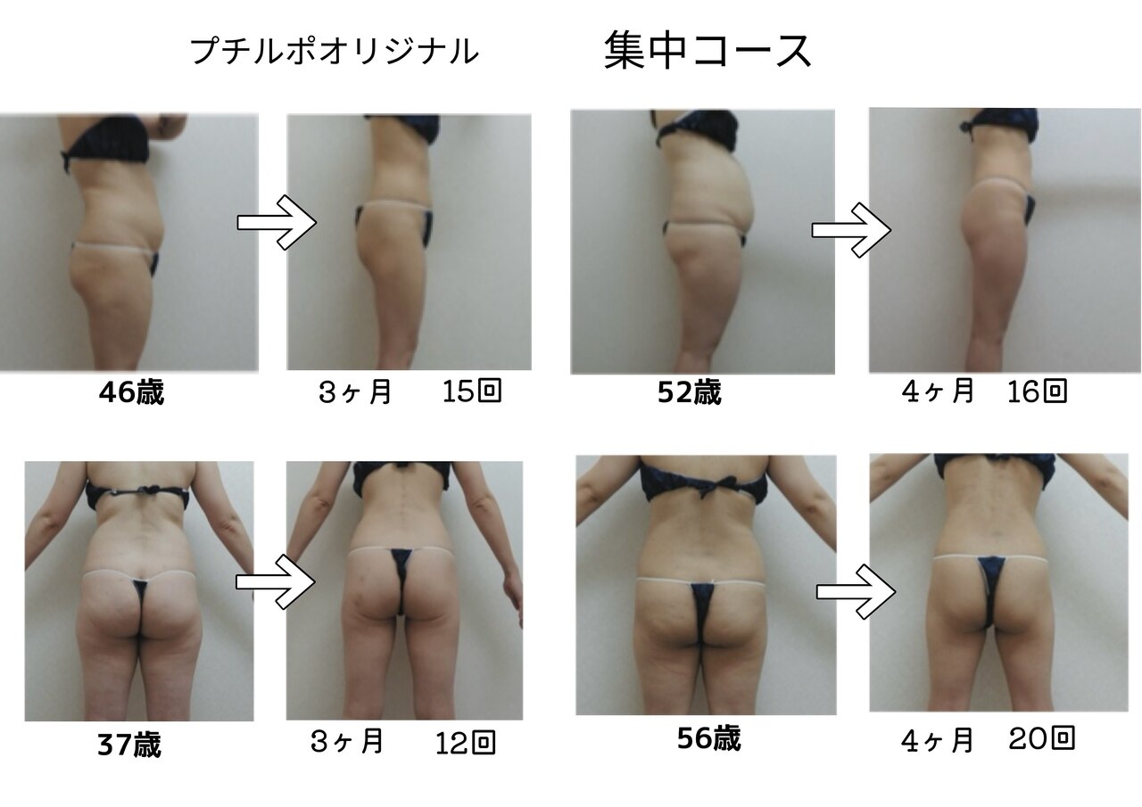 町田市でエンダモロジーが人気のエステサロン｜ホットペッパービューティー