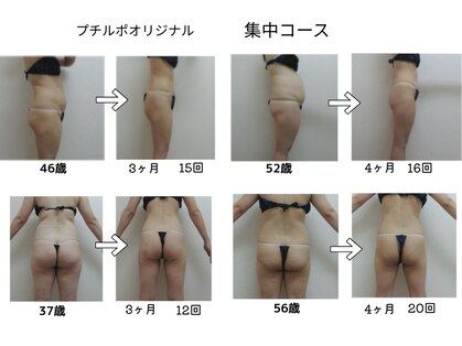 エステ&ビューティストレッチ プチルポの写真