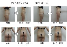 エステ&ビューティストレッチ プチルポ