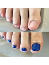 アーティネイルズ(Aaty Nails)/当日から見た目改善