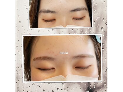 ミシャ(Micia)の写真