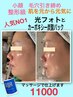 小顔最強!むくみ改善 毛穴もキュッ 炭酸ガスパックと光フォトセット11000