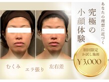 小顔フェイスラボ 一宮店(小顔 Face Labo.)