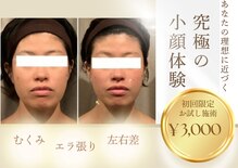 小顔フェイスラボ 一宮店(小顔 Face Labo.)