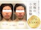 小顔フェイスラボ 一宮店(小顔 Face Labo.)の写真