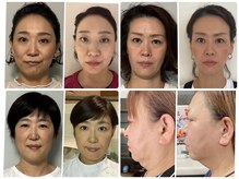 チェリー(Cherry)の雰囲気（完全個室でリラックスしながら、憧れの美小顔&昔の顔に巻き戻す）