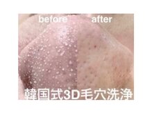 ビューティサロンテランセラ(beauty salon TELANTHERA)の雰囲気（SNSで大バズリ中★韓国式3D毛穴洗浄。皮脂・黒ずみ・角質ケア）