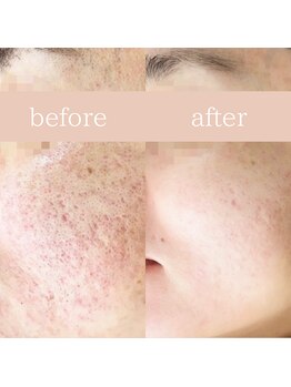 ハナワビューティーサロン(HanaWa beauty salon)/before&after