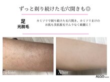 アルゴ 吹田千里山駅前店(ALGO)/【脚】