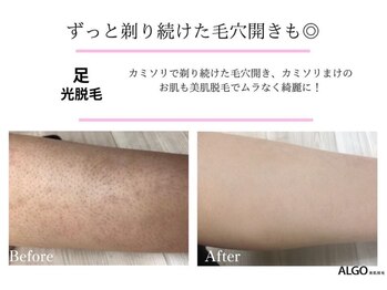 アルゴ 吹田千里山駅前店(ALGO)/【脚】