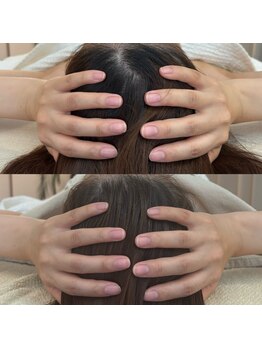 ケリービューティーサロン(kelly beauty salon)/脳洗浄