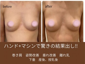 ハク 阪急茨木(HAKU)の写真/極上バストマッサージ!光豊胸マシーン導入店★左右差が気になる/ボリュームアップ/形を整えたい方必見◎