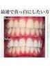 【プレジェル付き】セルフホワイトニング20分×2回照射