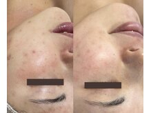 ロイヤル ビューティー サロン(Royal Beauty Saloon)/韓国発最新肌管理【セルマン】