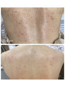 ベルシャトン(Belle Chaton)/