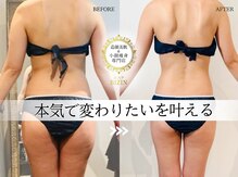 エステビジン 八事(エステBIZIN)