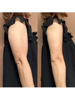 サロン ザファースト(Salon THE First)/痩身もたったの25分