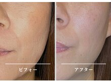 天神美容鍼99(KUKU)の雰囲気（ファンデより、すっぴんの方が綺麗で若々しく）