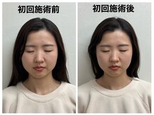 トータルバランス整体院 &nbsp;オレンジ(ORANGE)/小顔矯正/鼻と口元の歪み/むくみ