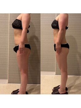 ギャラクシービューティー(galaxy beauty)/ハイパーナイフ