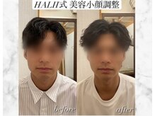 ハリートウキョウ(HALII TOKYO)/本物のリフトアップを叶える