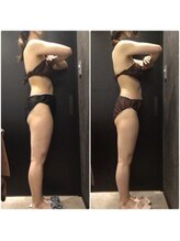 フローボディ 新山口店(flow BODY)/山口のエステはflow BODY