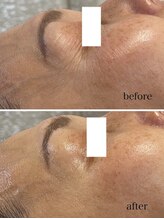 ジェイ(J)/ララピール☆1回でわかるハリ艶