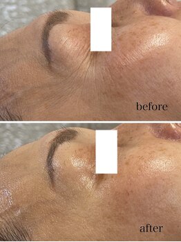 ジェイ(J)/ララピール☆1回でわかるハリ艶