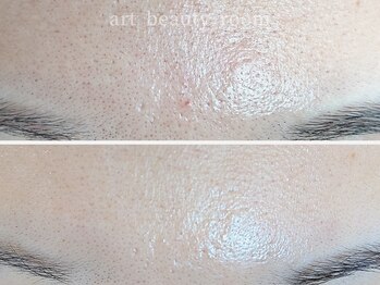 アート ビューティールーム(art beauty room)/☆XE'LHA PEEL （セラピール） 