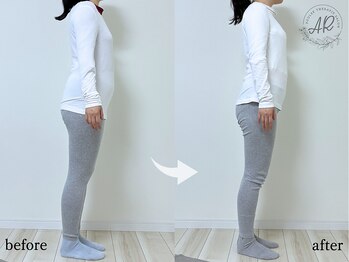 エーアール(AR)/【Before/After】4回目