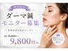 【限定10名様】ダーマ鍼モニター募集　19,800円