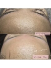 ジル(JILL)/スキンケアトリプルWAX