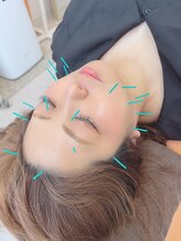ヒーリングサロン アージュ(A-je)/★美顔鍼＋小顔矯正★