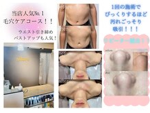 アリュール フェイスアンドボディ(allure Face&Body)の雰囲気（毛穴の悩みはココで解決！！人気ナンバー１毛穴コース！！）