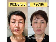 ハーボプラス(THE HEARBO plus)の雰囲気（定期に施術を受けることで、キレイをキープ出来ます！）