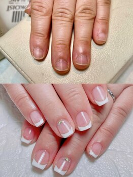 ハートライフ(Heart Life)の写真/《全ての女性が心から選んで良かったと思えるサロンを》お悩みに寄り添った丁寧なカウンセリングと施術♪