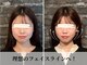 ハリユナイテッド 原宿鍼灸 整体院(HALI UNITED)の写真