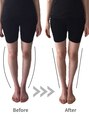 エテルナ 池袋店(ETERNA) 【お悩み】：O脚・むくみ【おすすめ施術】：O脚/全身矯正