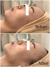 スペチアーレ 夙川/驚きのリフトアップ