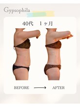 ジプソフィラ(Gypsophila)/痩身ビフォーアフター