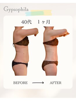 ジプソフィラ(Gypsophila)/痩身ビフォーアフター