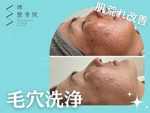 堺整骨院 小郡院