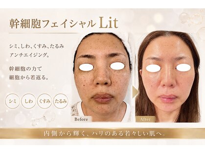 箔屋(hakuya)の写真