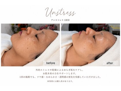 ノエル(Noel)の写真